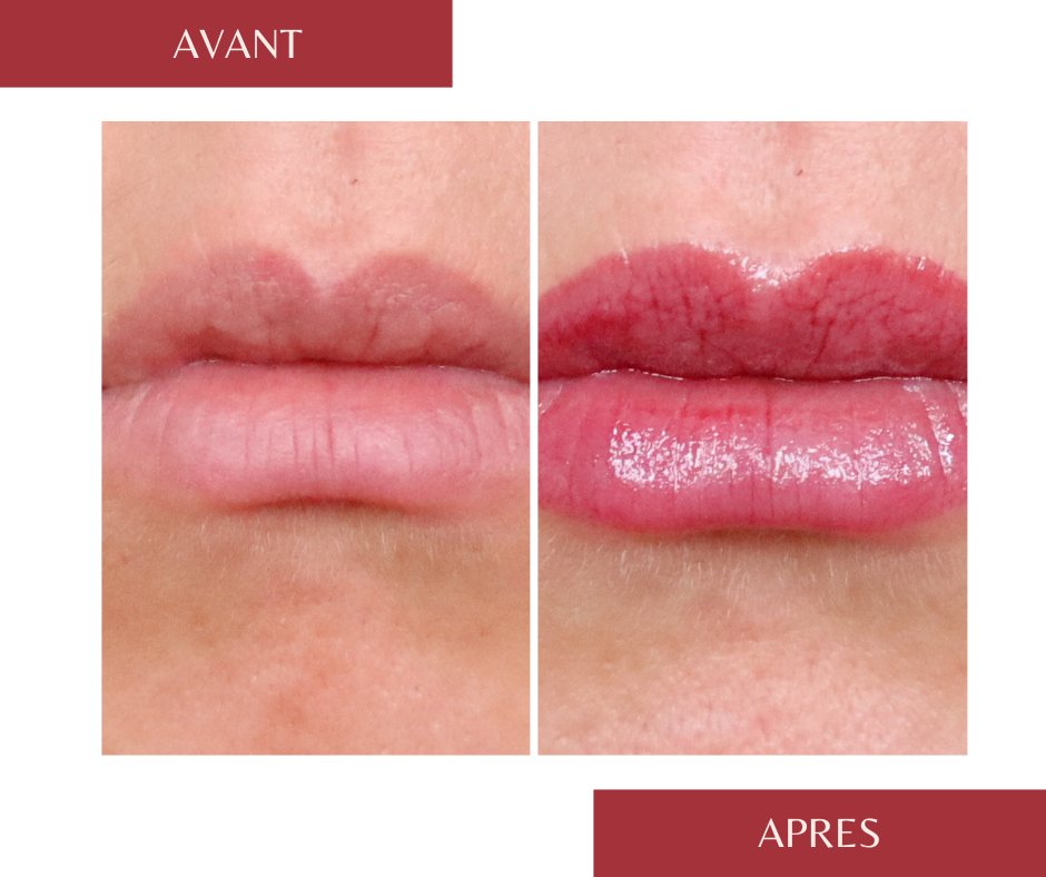 Gloss à Effet Repulpeur Haut de Gamme